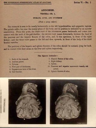 Stereoscopic Studies of Anatomy; Prepared under authority of the University of Edinburgh [Section VI Viscera | Perineum
